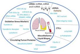 Durvalumab is an immunotherapy medication used to treat cancer, specifically cancers of the lung and bladder. Frontiers Liquid Biopsy In Malignant Pleural Mesothelioma State Of The Art Pitfalls And Perspectives Oncology