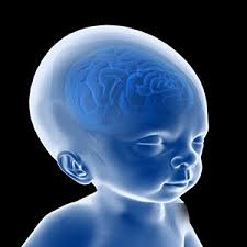 Image result for Hydrocephalus