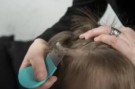 If they fall off, they die within 1. How To Spot Headlice Theschoolrun