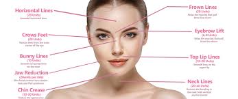 Typically, the masseter muscle is injected for 2 reasons: Botox Dysport Xeomin Cosmetic Frown Lines Crow S Feet Treatment In Pittsfield Ma