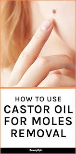 How To Use Castor Oil For Moles Removal Skin Moles Mole Removal Castor Oil