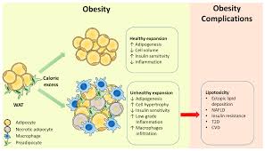 Most food labels will list how many grams of fat there are for each i actually do this all the time, except i calculate the grams of carbohydrate, necessary to dose properly with insulin, since i am diabetic. Ijms Free Full Text Adipose Tissue Dysfunction As Determinant Of Obesity Associated Metabolic Complications Html