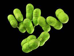 Listeria is responsible for around 1,600 illnessestrusted source and 260 deaths in the united states yearly, exceeding the fatality rates of salmonella and clostridium botulinum. Project To Look At 2019 Spanish Listeria Outbreak Food Safety News