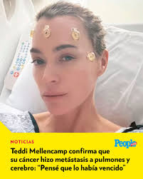🔗 bit.ly/3YaSAh9 Teddi Mellencamp la estrella de Real Housewives of  Beverly Hills tiene tumores en el cerebro y los pulmones. 🙏🏽