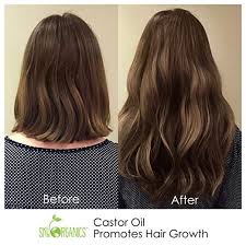 Amazon Com Castor Oil 16oz Usda Organic Cold Pressed 100 Pure Hexane Free Castor Oil Moisturizing Heal Dry Skin Hair Onion For Hair Thick Hair Styles