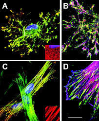 No change in the insulin regimen may be needed for brief hospitalization or for simple or outpatient procedures. The Myofibroblast The American Journal Of Pathology