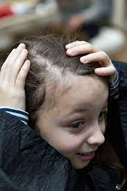 But hair loss also can be a side effect of some medicines used to treat acne, bipolar disorder, and adhd. What Can Cause Child Hair Loss