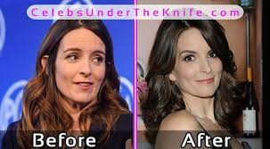 Tina Fey Plastic Surgery Before After Celebsundertheknife Celebs Celebrity Plasticsurgery Cele Celebrity Surgery Plastic Surgery Celebrity Plastic Surgery