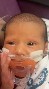 Little update:, Huxon is one week old already 🥹, He is scheduled to have  surgery