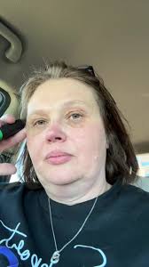 #cancersucks #cancer #lch #chemo #wewintogether