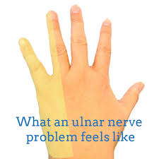 The pain radiates along the side of my hand up to the pinky finger. Pain In Your Wrist Carpal Tunnel Syndrome And Other Hand Shenanigans