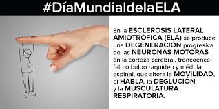 Es una enfermedad digestiva que daña el intestino delgado y altera la absorción de las vitaminas, minerales y demás nutrientes ¿cuáles son los síntomas de la enfermedad celíaca? Debilidad En Las Extremidades O En La Region Bulbar Primeros Sintomas De La Ela
