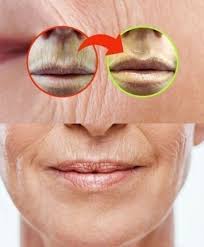 Natural remedy for mouth wrinkles