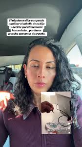 Hoy te explico la verdad detrás de la llamada “prueba epigenética capi...