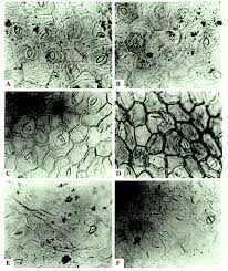 Image result for Afrobrunnichia erecta