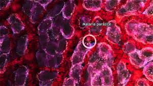 It is most common in tropical climates. Malaria Lifecycle Part 1 Human Host 2016 Youtube