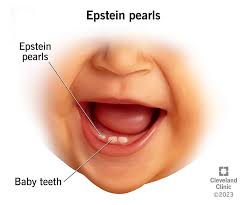 Image result for Neonatal Teeth
