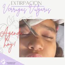 👩🏽‍⚕️¡Este es uno de los procedimientos más comunes en consulta!