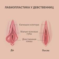 Лабиопластика малых половых губ в Минске - цены на интимную пластику