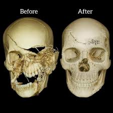[Image: images?q=tbn:ANd9GcTd6XO0ai1Aqbw7krUBWmD...t-a1YASw&s]