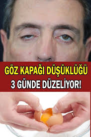 Evde Goz Kapagi Dusuklugu Nasil Tedavi Edilir Evde Nasil Yapilir 2020 Saglik Dusuk Gozler