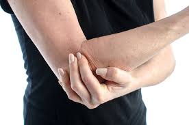 Check spelling or type a new query. Bursitis Gejala Penyebab Dan Mengobati Alodokter