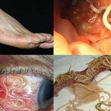 Cuidado Estos Son 10 Aterradores Parasitos Que Pueden Invadir Tu Cuerpo Fotos Ciencia Peru21
