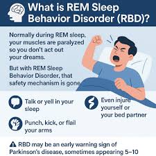 Image result for REM Sleep Behavior Disorder
