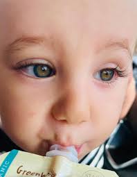 Baby's Unique Eye Color: Will it Change?