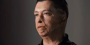 Harborview Medical Center — Why Harborview Matters