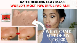 Maybe you would like to learn more about one of these? How I Remove My Stubborn Blackheads World S Most Powerful Facial Aztec Indian Healing Clay Mask Youtube