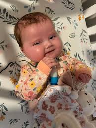 Hello everyone This is my daughter she is 12 yrs old. Her name is Madison.  A very rare thing happened to her transplanted kidney, It actually flipped  inside of her and her