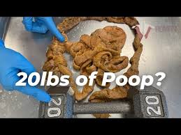 Could Your Old Poop Cure You Of Future Diseases? | Wired