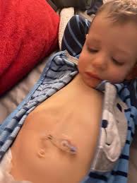 Finding an adult doctor specializing in G-tubes for Jared