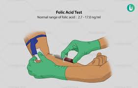 Image result for Serum Folate