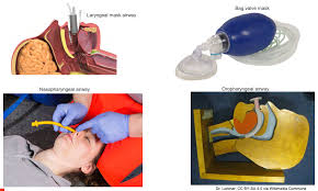 Image result for LET Anesthesia