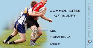 Maybe you would like to learn more about one of these? How To Prevent Rugby Injuries Of The Lower Extremity Mass4d Foot Orthotics
