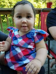 Alannah's Fibular Hemimelia