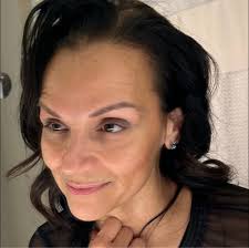 Do collagen supplements help with sagging skin post sleeve?