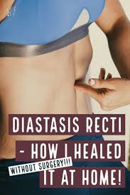 How To Improve Diastasis Recti And Pelvic Floor Dysfunction Natalie Hodson Diastasis Recti Diastasis Diastasis Recti Exercises