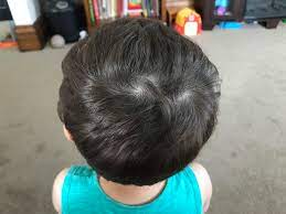 Use them in commercial designs under lifetime, perpetual & worldwide rights. My Son Has 3 Hair Whorls Mildlyinteresting