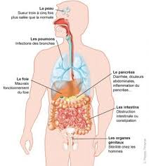 Vaincre la mucoviscidose, paris, france. Mucoviscidose Symptomes Et Traitement Medipedia