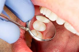 International recognition · scholarly articles · widely indexed Root Canal Therapy Dental Artistry