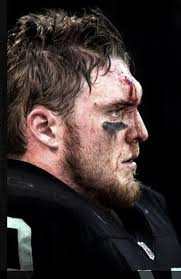 Jon Ritchie : r/raiders