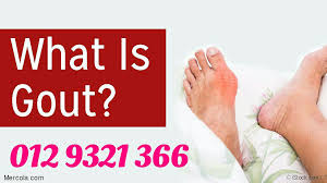 Jangan hanya berfokus pada nasib buruk yang menimpa, tetapi fokuslah pada perbaikan yang bisa anda lakukan dan mengubah takdir. Penawar Gout Publicaciones Facebook