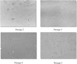 Find jobs in selangor by nurikhwah medical services sdn bhd on mudah.my. Benchtop Isolation And Characterisation Of Small Extracellular Vesicles From Human Mesenchymal Stem Cells Springerlink