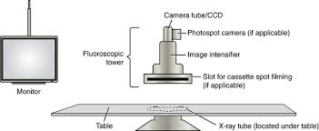 Image Intensified Fluoroscopy Radiology Key
