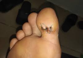 How can i remove lots of tiny wood splinters? Goddamn Toe Splinter Minh Ha S Blog