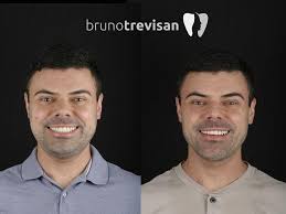 Croácia 🇭🇷 pt2 Praias Incríveis Split Hvar Dubrovnik