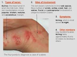 Image result for scabies symptoms